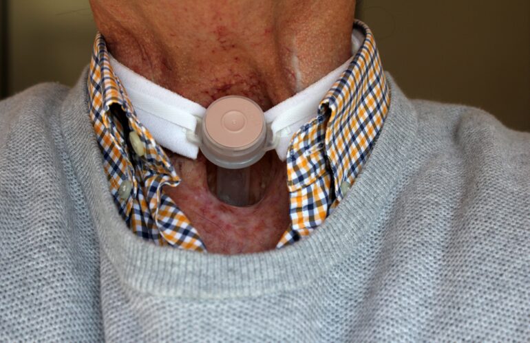 Tracheostomy Tube 